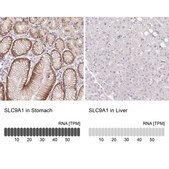 Anti-SLC9A1 antibody produced in rabbit Prestige Antibodies&#174; Powered by Atlas Antibodies, affinity isolated antibody, buffered aqueous glycerol solution