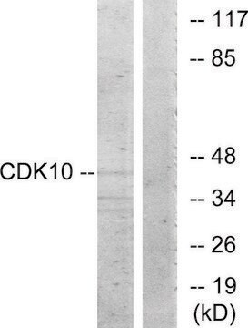 Anti-CDK10 antibody produced in rabbit affinity isolated antibody