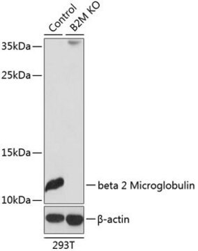 Anti-beta 2 Microglobulin antibody produced in rabbit