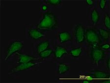 Monoclonal Anti-STIM1 antibody produced in mouse clone 5A2, purified immunoglobulin, buffered aqueous solution