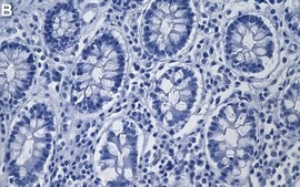 Anti- Galectin-3 Antibody, clone 1J2-H1 ZooMAb&#174; Rabbit Monoclonal recombinant, expressed in HEK 293 cells