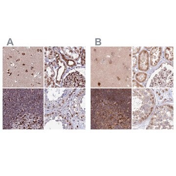 Anti-TOR1AIP1 antibody produced in rabbit Prestige Antibodies&#174; Powered by Atlas Antibodies, affinity isolated antibody, buffered aqueous glycerol solution