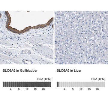 Anti-SLC6A6 antibody produced in rabbit Prestige Antibodies&#174; Powered by Atlas Antibodies, affinity isolated antibody, buffered aqueous glycerol solution, Ab2