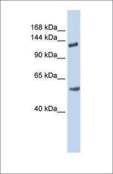 Anti-ROBO2 antibody produced in rabbit affinity isolated antibody