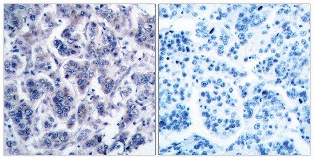 Anti-TYK2 antibody produced in rabbit affinity isolated antibody