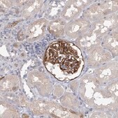 Anti-EPB41L5 antibody produced in rabbit Prestige Antibodies&#174; Powered by Atlas Antibodies, affinity isolated antibody, buffered aqueous glycerol solution