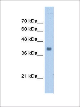 Anti-ALDOA antibody produced in rabbit IgG fraction of antiserum