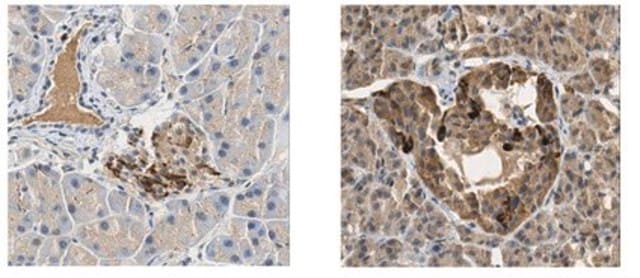 Anti-PDX-1 Antibody from rabbit, purified by affinity chromatography