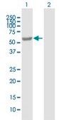 Anti-EPHX2 antibody produced in mouse IgG fraction of antiserum, buffered aqueous solution