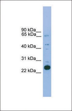 Anti-NKX2-6, (N-terminal) antibody produced in rabbit affinity isolated antibody