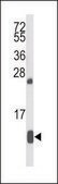 ANTI-HBA2 (CENTER) antibody produced in rabbit IgG fraction of antiserum, buffered aqueous solution