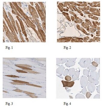 Anti-MLC-2 Antibody, clone 19D3.1 clone 19D3.1, from mouse