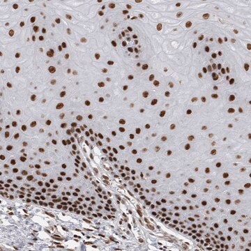 Anti-EYA2 antibody produced in rabbit Prestige Antibodies&#174; Powered by Atlas Antibodies, affinity isolated antibody, buffered aqueous glycerol solution