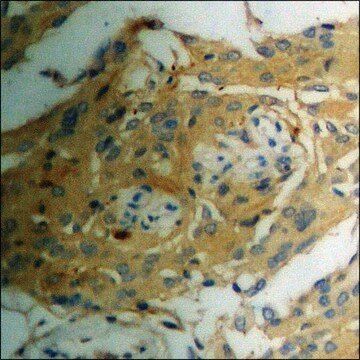 Anti-phospho-NMDAR1 (pSer890) antibody produced in rabbit affinity isolated antibody
