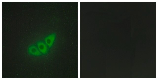 Anti-E2AK3 antibody produced in rabbit affinity isolated antibody