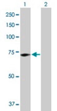 Anti-GALC antibody produced in rabbit purified immunoglobulin, buffered aqueous solution