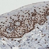 Monoclonal Anti-ESR1 antibody produced in mouse Prestige Antibodies&#174; Powered by Atlas Antibodies, clone CL1196, purified immunoglobulin, buffered aqueous glycerol solution