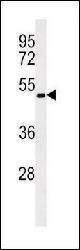 ANTI-OPN1MW (N-TERM) antibody produced in rabbit IgG fraction of antiserum, buffered aqueous solution