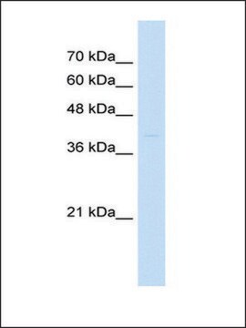 Anti-ST3GAL3 (AB1) antibody produced in rabbit affinity isolated antibody