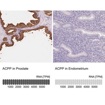 Anti-ACPP antibody produced in rabbit Prestige Antibodies&#174; Powered by Atlas Antibodies, affinity isolated antibody, buffered aqueous glycerol solution