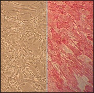 Human Carotid Artery Smooth Muscle Cells: HCtASMC, adult