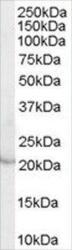 Anti-Lipocalin 2/NGAL (AB1) antibody produced in goat affinity isolated antibody, buffered aqueous solution