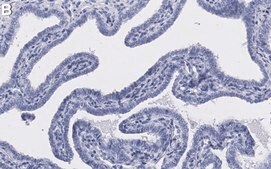 Anti-Progesterone Receptor Antibody, clone 1D2 ZooMAb&#174; Rabbit recombinant, expressed in HEK 293 cells