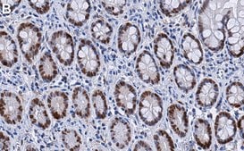 Anti-Vitamin D3 Receptor Antibody, clone 1M19 ZooMAb&#174; Rabbit Monoclonal recombinant, expressed in HEK 293 cells