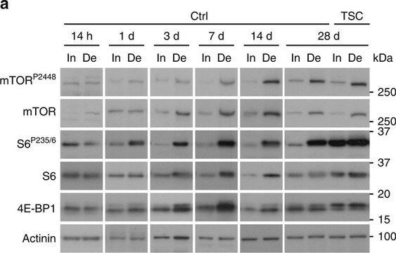 Monoclonal Anti-&#945;-Actinin antibody produced in mouse clone BM-75.2, ascites fluid