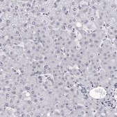 Anti-MYOC antibody produced in rabbit Prestige Antibodies&#174; Powered by Atlas Antibodies, affinity isolated antibody, buffered aqueous glycerol solution