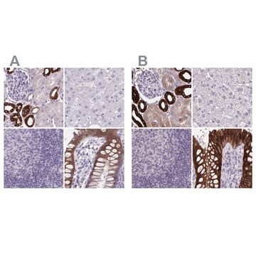 Anti-HSD11B2 antibody produced in rabbit Prestige Antibodies&#174; Powered by Atlas Antibodies, affinity isolated antibody, buffered aqueous glycerol solution