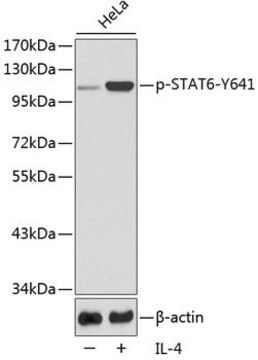 Anti-Phospho-STAT6-Y641 antibody produced in rabbit