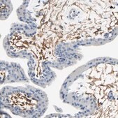 Anti-PDPN antibody produced in rabbit Prestige Antibodies&#174; Powered by Atlas Antibodies, affinity isolated antibody, buffered aqueous glycerol solution