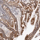 Anti-CPT2 antibody produced in rabbit Prestige Antibodies&#174; Powered by Atlas Antibodies, affinity isolated antibody, buffered aqueous glycerol solution, ab1