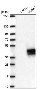 Anti-VSIG2 antibody produced in rabbit Prestige Antibodies&#174; Powered by Atlas Antibodies, affinity isolated antibody, buffered aqueous glycerol solution