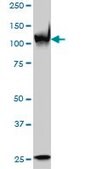 Monoclonal Anti-PARP1 antibody produced in mouse clone 3G4, purified immunoglobulin, buffered aqueous solution