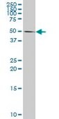 Monoclonal Anti-CASP10, (N-terminal) antibody produced in mouse clone 2E7, purified immunoglobulin, buffered aqueous solution