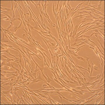 Canine Coronary Artery Smooth Muscle Cells: CnCASMC (Cryovial)