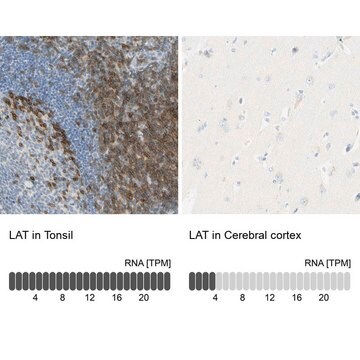 Anti-LAT antibody produced in rabbit Prestige Antibodies&#174; Powered by Atlas Antibodies, affinity isolated antibody, buffered aqueous glycerol solution