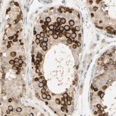 Anti-KIF11 antibody produced in rabbit affinity isolated antibody, Prestige Antibodies&#174; Powered by Atlas Antibodies, buffered aqueous glycerol solution