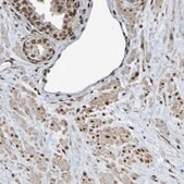 Anti-HDAC2 antibody produced in rabbit affinity isolated antibody, buffered aqueous glycerol solution