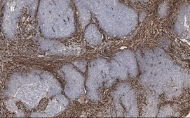 Anti-TAGLN Antibody, clone 1D10 , ZooMAb&#174; Rabbit Monoclonal recombinant, expressed in HEK 293 cells