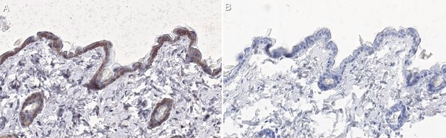 Anti-Serpin B13 Antibody, clone B34