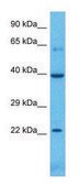 Anti-CASP10 (C-terminal) antibody produced in rabbit affinity isolated antibody