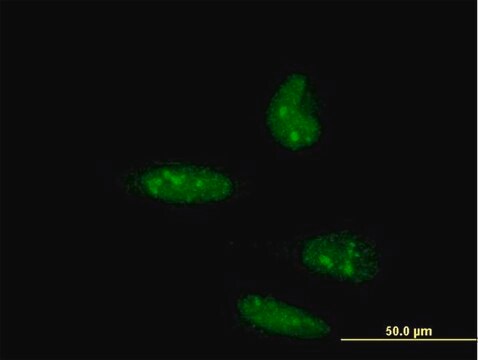 ANTI-ATOH1 antibody produced in mouse clone 2A12, purified immunoglobulin, buffered aqueous solution