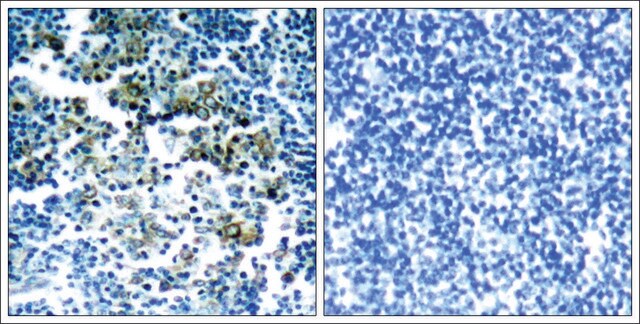 Anti-phospho-BCR (pTyr177) antibody produced in rabbit affinity isolated antibody