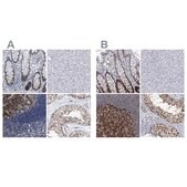 Anti-PCNA antibody produced in rabbit Prestige Antibodies&#174; Powered by Atlas Antibodies, affinity isolated antibody, buffered aqueous glycerol solution, ab1