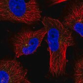 Anti-PRKAR2A antibody produced in rabbit Prestige Antibodies&#174; Powered by Atlas Antibodies, affinity isolated antibody, buffered aqueous glycerol solution