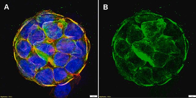 Anti-MYH14/Myosin-14 Antibody, clone 2B4 ZooMAb&#174; Rabbit Monoclonal recombinant, expressed in HEK 293 cells