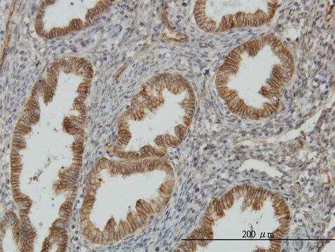 Monoclonal Anti-NDRG1 antibody produced in mouse clone 2D7, purified immunoglobulin, buffered aqueous solution